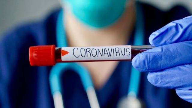 médico segura amostra de sangue com etiqueta escrito coronavírus