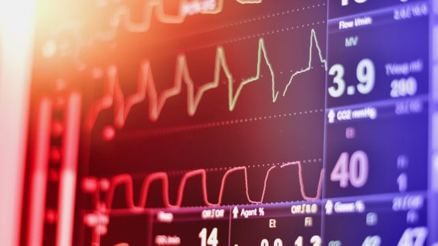 Ekg,Monitor,In,Intra,Aortic,Balloon,Pump,Machine,In,Icu